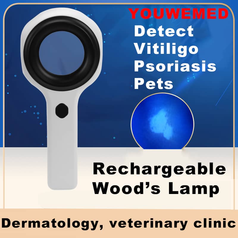 365nm UV-A light source for skin observation
