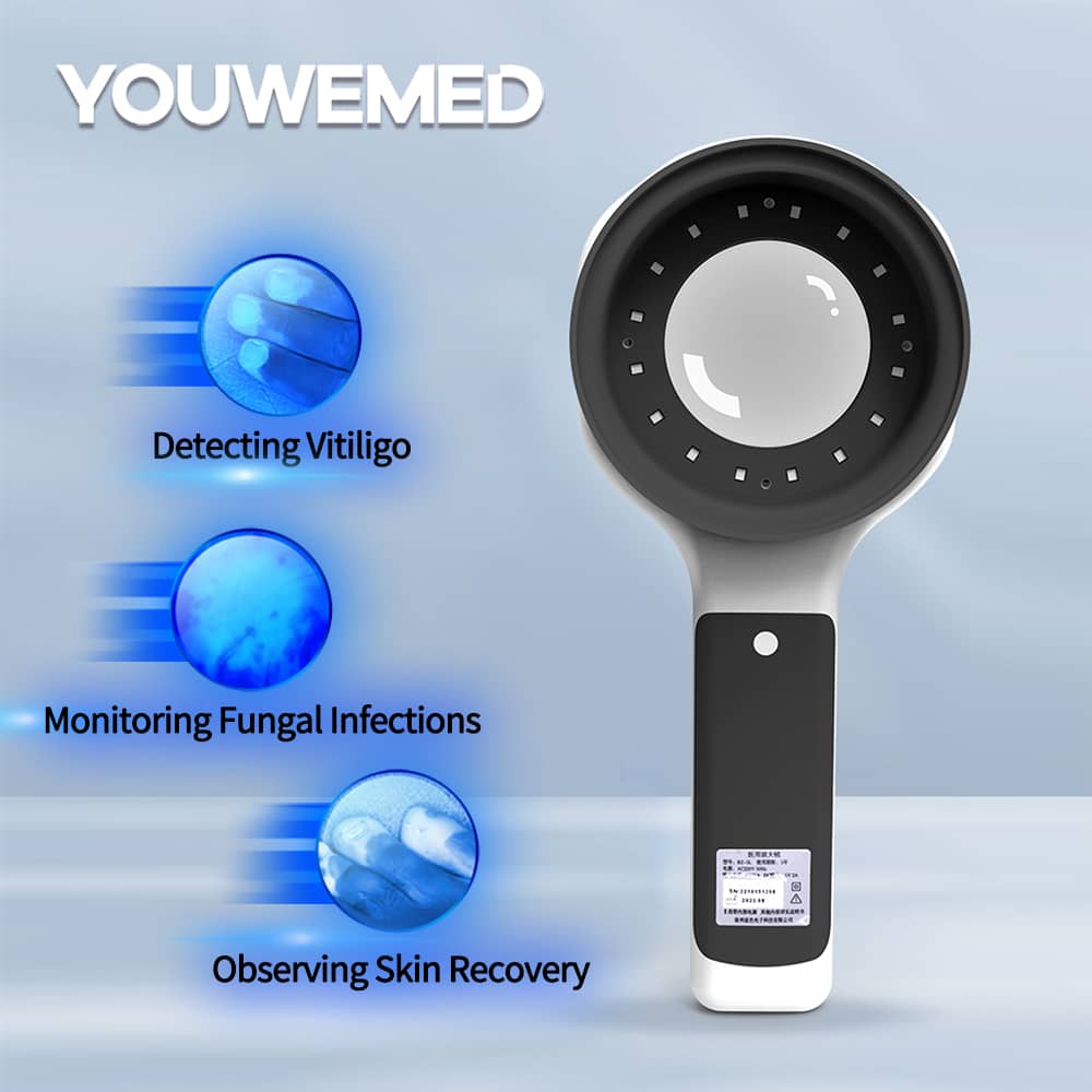 Portable Wood's Lamp for skin and pet inspection